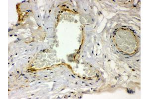 Anti- Thrombin Receptor antibody, IHC(P) IHC(P): Human Placenta Tissue (PAR1 anticorps  (N-Term))