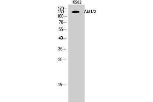 Western Blotting (WB) image for anti-Abelson Murine Leukemia Viral Oncogene Homolog 1/2 (ABL1/ABL2) (Lys5) antibody (ABIN3173634) (ABL1/2 anticorps  (Lys5))