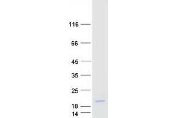 TAL2 Protein (Myc-DYKDDDDK Tag)