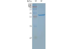 Human A4-Nanodisc, Flag Tag on SDS-PAGE (SLC25A4 Protéine)