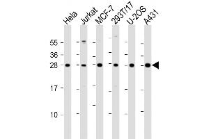 Western Blot at 1:2000 dilution Lane 1: Hela whole cell lysate Lane 2: Jurkat whole cell lysate Lane 3: MCF-7 whole cell lysate Lane 4: 293T/17 whole cell lysate Lane 5: U-2OS whole cell lysate Lane 6: A431 whole cell lysate Lysates/proteins at 20 ug per lane. (RPL14 anticorps  (AA 117-147))