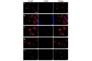 Image no. 7 for anti-Glial Fibrillary Acidic Protein (GFAP) (AA 51-150) antibody (ABIN726200)