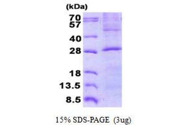 GOSR2 Protein (His tag)