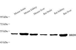 Western blot analysis of BRD9 (ABIN7073233),at dilution of 1: 1500 (BRD9 anticorps)