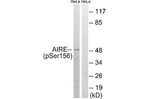 Western blot analysis of extracts from HeLa cells treated with Hu using AIRE (Phospho-Ser156) Antibody. (AIRE anticorps  (pSer156))