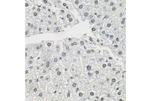 Immunohistochemistry of paraffin-embedded mouse liver using TCEB1 antibody (ABIN5999020) (40x lens). (TCEB1 anticorps)