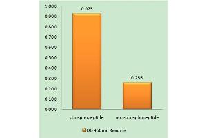 Immunohistochemistry analysis of paraffin-embedded human brain tissue using ITCH (Phospho-Tyr420) antibody. (ITCH anticorps  (pTyr420))