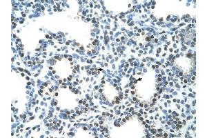 Semenogelin I antibody was used for immunohistochemistry at a concentration of 4-8 ug/ml to stain Alveolar ceils (arrows) in Human Lung. (SEMG1 anticorps  (N-Term))