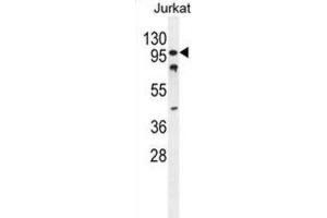 Western Blotting (WB) image for anti-CWC22 Spliceosome-Associated Protein Homolog (CWC22) antibody (ABIN2995841) (CWC22 anticorps)