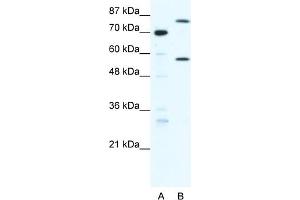 WB Suggested Anti-MYNN Antibody Titration:  1. (Myoneurin anticorps  (Middle Region))