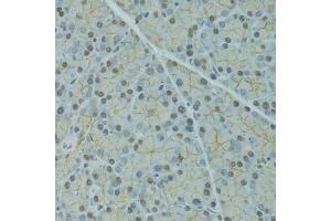 Immunohistochemistry of paraffin-embedded rat pancreas using SERPINF2 antibody  at dilution of 1:100 (40x lens). (alpha 2 Antiplasmin anticorps  (AA 302-491))