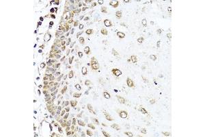 Immunohistochemistry of paraffin-embedded human esophagus using RAC2 antibody. (RAC2 anticorps)