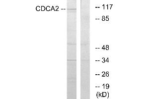 Western blot analysis of extracts from 293 cells, using CDCA2 antibody. (CDCA2 anticorps)