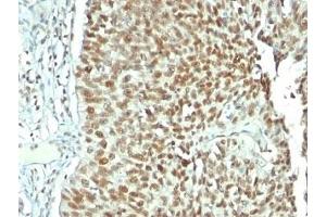 Immunohistochemistry (Formalin-fixed Paraffin-embedded Sections) (IHC (fp)) image for anti-Nucleolin (NCL) antibody (ABIN3025709)