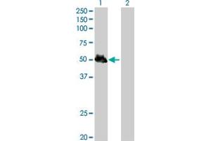 Western Blot analysis of KRT8 expression in transfected 293T cell line by KRT8 MaxPab polyclonal antibody. (KRT8 anticorps  (AA 1-483))