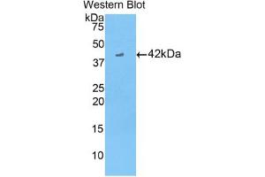 Western blot analysis of the recombinant protein. (CKB anticorps  (AA 11-367))