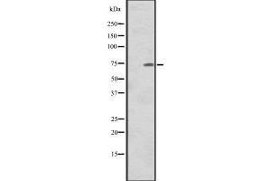 Western blot analysis of CNNM1 expression in Human tonsil tissue lysate,The lane on the left is treated with the antigen-specific peptide. (Cyclin M1 anticorps)