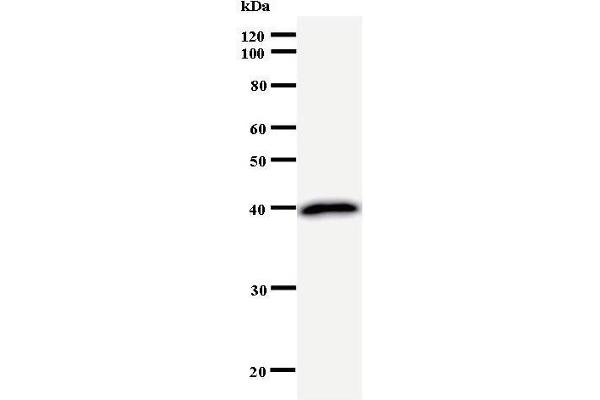 TPX2 anticorps