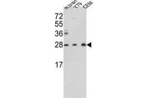 Western blot analysis of TPI1 Antibody (TPI1 anticorps  (N-Term))