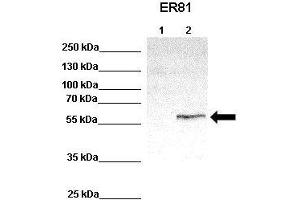 WB Suggested Anti-ETV1 Antibody    Positive Control:  Lane 1: 100ug untransfected HEK293 lysate Lane 2: 33ug ER81 transfected HEK293 lysate   Primary Antibody Dilution :   1:1000  Secondary Antibody :  Anti-rabbit-HRP   Secondry Antibody Dilution :   1:2000  Submitted by:  Anonymous (ETV1 anticorps  (Middle Region))