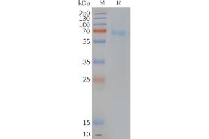 Human PT-Nanodisc, Flag Tag on SDS-PAGE (Prostaglandin D2 Receptor 2 (PTGDR2) Protéine)