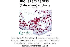 Image no. 1 for anti-serine/arginine-Rich Splicing Factor 3 (SRSF3) antibody (ABIN1739659) (SRSF3 anticorps)