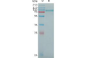 Human SB Protein, His Tag on SDS-PAGE under reducing condition. (SEMA4B Protein (AA 44-716) (His tag))