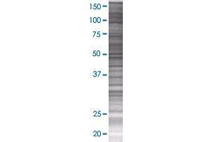 THEM4 transfected lysate. (THEM4 293T Cell Transient Overexpression Lysate(Denatured))