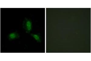 Immunofluorescence analysis of HeLa cells, using IRS-1 (Ab-312) Antibody. (IRS1 anticorps  (AA 279-328))