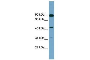 DGKA antibody used at 1 ug/ml to detect target protein. (DGKA anticorps  (N-Term))