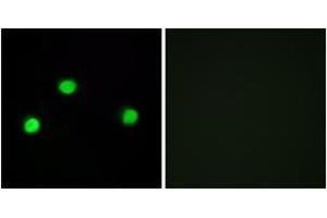 Immunofluorescence analysis of COS7 cells, using IP6K2 Antibody. (IP6K2 anticorps  (AA 161-210))
