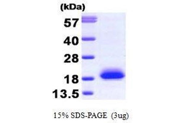 VSNL1 Protein (AA 1-191)