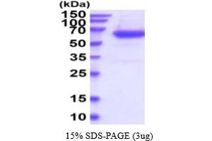 SDS-PAGE (SDS) image for Plasminogen Activator, Tissue (PLAT) (AA 311-562) protein (His tag) (ABIN6387935) (PLAT Protein (AA 311-562) (His tag))