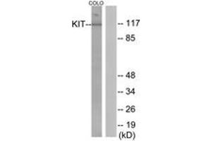 Western Blotting (WB) image for anti-Mast/stem Cell Growth Factor Receptor (KIT) (AA 906-955) antibody (ABIN2888670) (KIT anticorps  (AA 906-955))