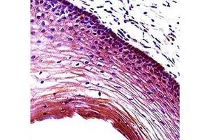 Puma antibody immunohistochemistry analysis in formalin fixed and paraffin embedded human cervix tissue. (PUMA anticorps  (AA 109-137))