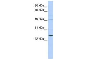 Image no. 1 for anti-Kv Channel Interacting Protein 2 (KCNIP2) (N-Term) antibody (ABIN6742581) (KCNIP2 anticorps  (N-Term))