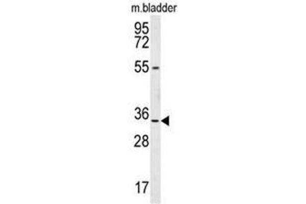 LRRC18 anticorps  (C-Term)