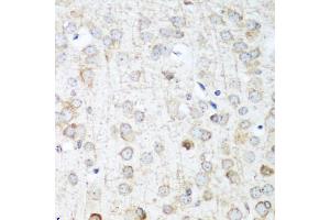 Immunohistochemistry of paraffin-embedded mouse brain using ANKRD52 antibody (ABIN5974842) at dilution of 1/100 (40x lens). (ANKRD52 anticorps)