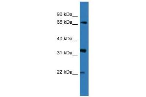 Western Blot showing DOK4 antibody used at a concentration of 1-2 ug/ml to detect its target protein. (DOK4 anticorps  (N-Term))