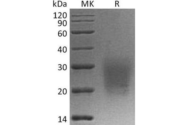 CD3D Protein (His tag)