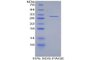 SDS-PAGE analysis of Human Torsin 3A Protein. (TOR3A Protéine)