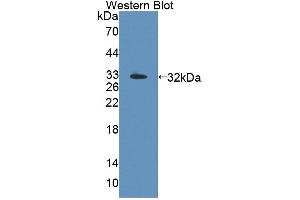 Western blot analysis of the recombinant protein. (TOP3B anticorps  (AA 1-250))