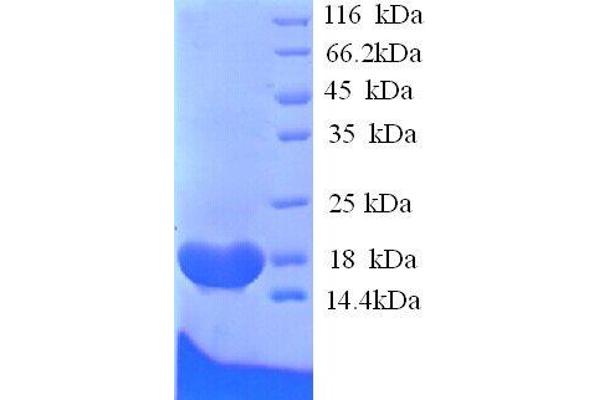 Butyrylcholinesterase Protein (BCHE) (AA 1-141, full length) (His tag)