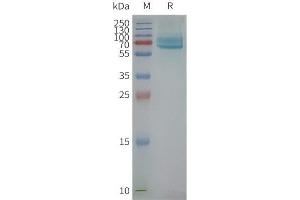 Human CD39-Nanodisc, Flag Tag on SDS-PAGE (CD39 Protéine)