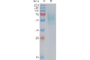 Mouse 5T4 Protein, His Tag on SDS-PAGE under reducing condition. (TPBG Protein (AA 32-361) (His tag))