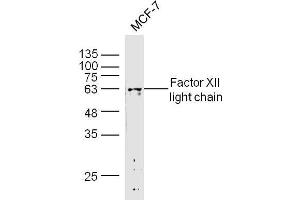 MCF-7 lysates probed with Factor I heavy chain Polyclonal Antibody, Unconjugated  at 1:300 dilution and 4˚C overnight incubation. (Factor I Heavy Chain (AA 261-360) anticorps)
