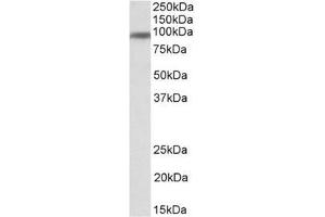 Staining of Human Breast lysate using CD71 / TFRC Antibody at 1 µg/ml (35µg protein in RIPA buffer). (Transferrin Receptor anticorps  (N-Term))