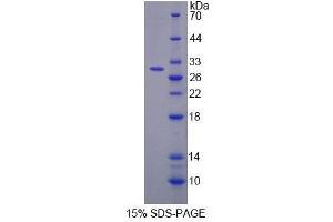 SDS-PAGE (SDS) image for Triadin (TRDN) (AA 486-687) protein (His tag) (ABIN6239147) (Triadin Protein (TRDN) (AA 486-687) (His tag))