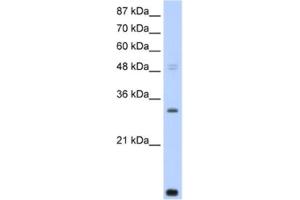 Western Blotting (WB) image for anti-CCR4-NOT Transcription Complex, Subunit 7 (CNOT7) antibody (ABIN2461842) (CNOT7 anticorps)