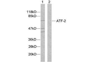 Western blot analysis of extracts from MDA-MB-435 cells using ATF-2 (Ab-112 or 94) antibody (E021033). (ATF2 anticorps)